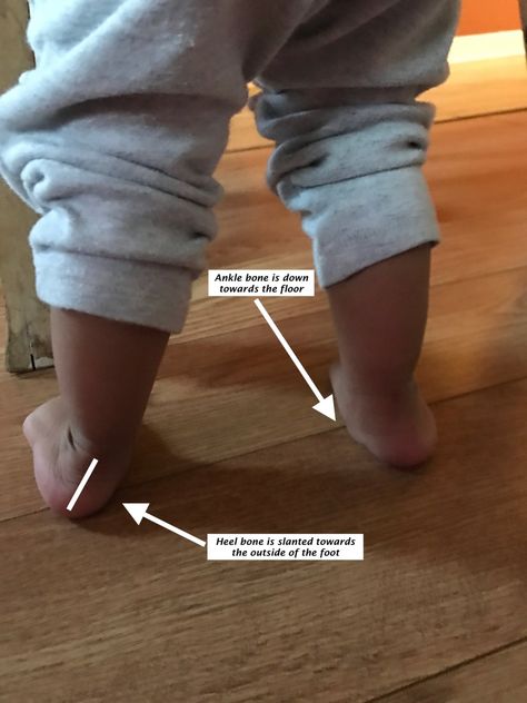 Flat feet in children- thoughts from a PT Toddler Exercise, Strengthen Ankles, Preschool Gym, Ankle Strengthening Exercises, Ankle Exercises, Feet Therapy, Foot Exercises, Easy Toddler Activities, Hair Fixing