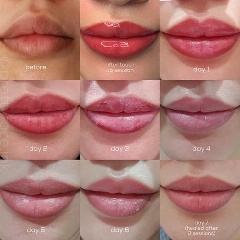 Lip Blush Healing Process - Day by Day Timeline and Stages Lip Blushing Tattoo Healing Stages, Lip Blush Colors For Blondes, Lip Tattoo Healing Process, Lip Blushing Healing Process, Pmu Lips Healing Process, Lipblush Before And After, Healed Lip Blush, Lip Filler Healing Stages, Lip Blushing Tattoo Healing