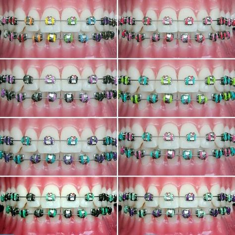 Looking to add some color to your braces? Try one of these combinations at your next appointment Brasses Teeth Color, Braces Colour Ideas, Pretty Braces Colors, Pretty Braces, Braces Colors Combinations, Invisible Teeth Braces, Braces Care, Braces Retainer, Orthodontics Teeth