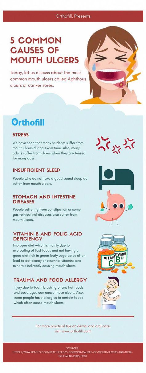 #oral #care #mouthwash #pocket #disc 5 Common Causes of Mouth Ulcers. Dental Infographics to make you more aware of dental and oral problems. Visit www.Orthofill.com to learn more! #HowToCareForOralSurgery #HowImportantIsOralCare #WhatIsOralHealthCare #OralDentalCare #WhatIsMoonOralCare #PreventiveOralHealthCare Dental Infographics, Tooth Caries, Abscess Tooth, Medicine Tips, Gastrointestinal Disease, Pediatric Dentist, How To Prevent Cavities, Oral Care Routine, Periodontal Disease