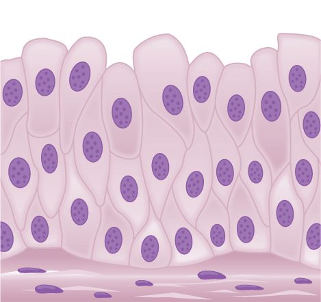 Transitional epithelia of the urinary bladder undergo changes in thickness depending on how full the bladder is. Epithelial Tissue, Cardiac Muscle Cell, Stratified Squamous Epithelium, Facilitated Diffusion, Loose Connective Tissue, Hyaline Cartilage, Tissue Biology, Urinary Bladder, Histology Slides