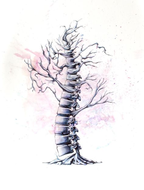 Physio Logo, Spine Drawing, Chiropractic Art, Cauda Equina, Crooked Tree, Spinal Fusion, Craniosacral Therapy, Cabinet Medical, Spine Surgery