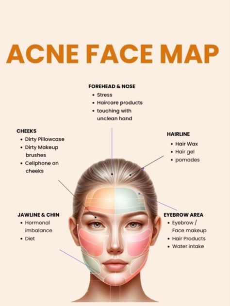 Understand your acne better with face mapping. Here we've pinpointed problem areas on your face. Find out what’s causing your acne and fix it.