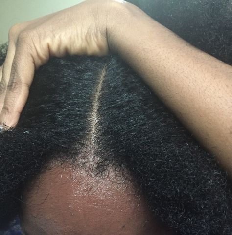 A clean scalp is the first step to healthy hair #washday #4b #4c #curlkink #blackgirl Retaining Length 4c Hair, 4c Healthy Hair, Hair Care Aesthetic Curly, Healthy 4c Hair Aesthetic, 4c Hair Aesthetic, Healthy 4c Hair, Healthy Hair Aesthetic, Healthy Black Hair, Thick Natural Hair