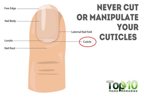 never cut cuticles or manipulate your nails How To Cut Cuticles At Home, Infected Cuticle, Vitamin Deficiency Symptoms, Top 10 Home Remedies, Nail Infection, Vitamin Deficiency, Nails Today, Healthy Mindset, Healthy Nails