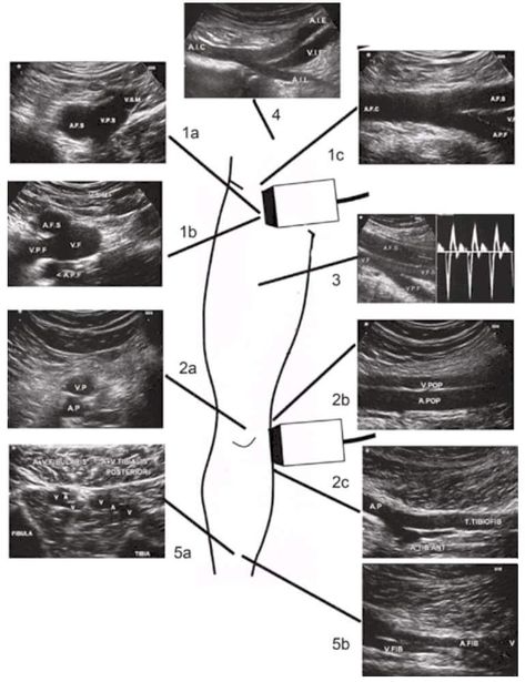 Vascular Sonography, Ultrasound Technician School, Medical Sonography Student, Diagnostic Medical Sonography Student, Ultrasound School, Ultrasound Physics, Cardiac Sonography, Doppler Ultrasound, Vascular Ultrasound