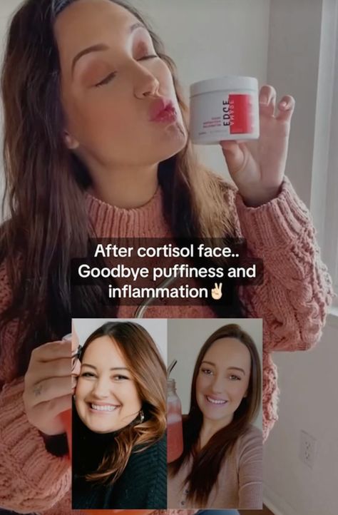 What Is Cortisol Face? A Side Effect Caused By Stress Moon Face Cortisol, Cortisol Face Before And After, How To Get Rid Of Cortisol Face, Cortisol Face, Cushing’s Syndrome, Tiktok People, Facial Puffiness, Lower Cortisol Levels, High Cortisol