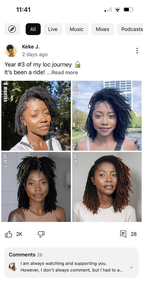 Micro Locs Hairstyles, Micro Locs Vs Sister Locs, Mirco Locs, Loc Growth, Short Dreadlocks, Locs Journey, Dread Locks, Loc Inspiration, Micro Locs