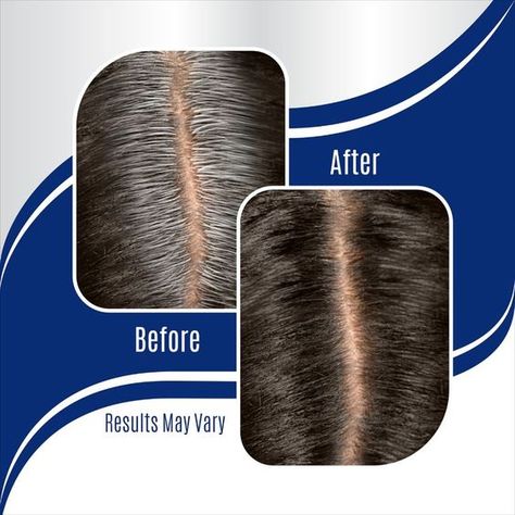 Gray Hair Solutions, Dimensional Hair Color, Hair Dye Tips, Thick Hair Remedies, Root Cover Up, Hair Steamers, Grey Roots, Easy Cream, Root Touch Up