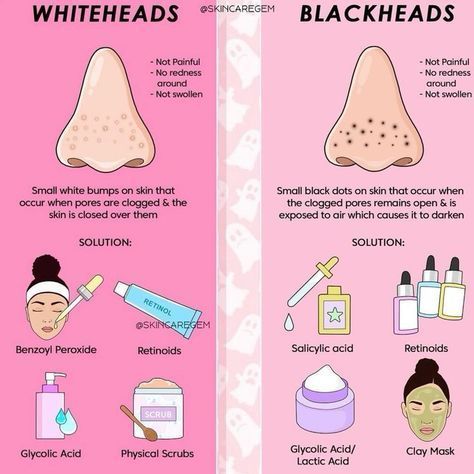 Remove Whiteheads, Haut Routine, Blackheads On Nose, Skin Advice, Basic Skin Care Routine, Perfect Skin Care Routine, Get Rid Of Blackheads, Healthy Skin Tips, Skin Routine