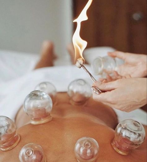 What Is Cupping Therapy, Massage Pictures, Cupping Massage, Acupuncture Clinic, Facial Cupping, Massage Therapy Techniques, Cupping Therapy, Massage Room, Female Doctor