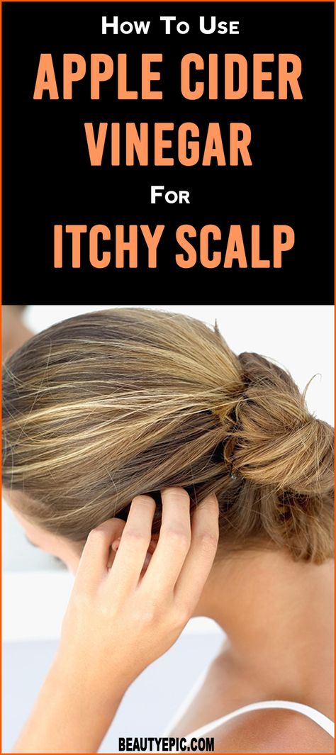 How to Use Apple Cider Vinegar (ACV) for Dry Itchy Scalp Itchy Dry Scalp Remedy, Apple Cider Vinegar Scalp, Itchy Scalp Remedy, Dry Scalp Remedy, Acv Hair, Drinking Apple Cider Vinegar, Apple Cider Vinegar For Hair, Dandruff Remedy, Dry Itchy Scalp