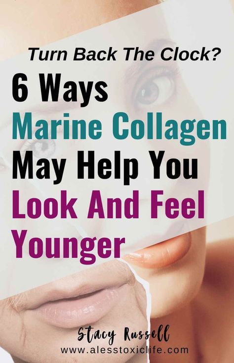 6 Ways Marine Collagen May Help You Look And Feel Younger - Benefits Of Marine Collagen, Vital Proteins Collagen Before And After, Marine Collagen Benefits, Collagen Peptides Benefits, What Is Acai, Collagen Skin Care, Health Benefits Of Collagen, Bad Acne, Eliminate Wrinkles