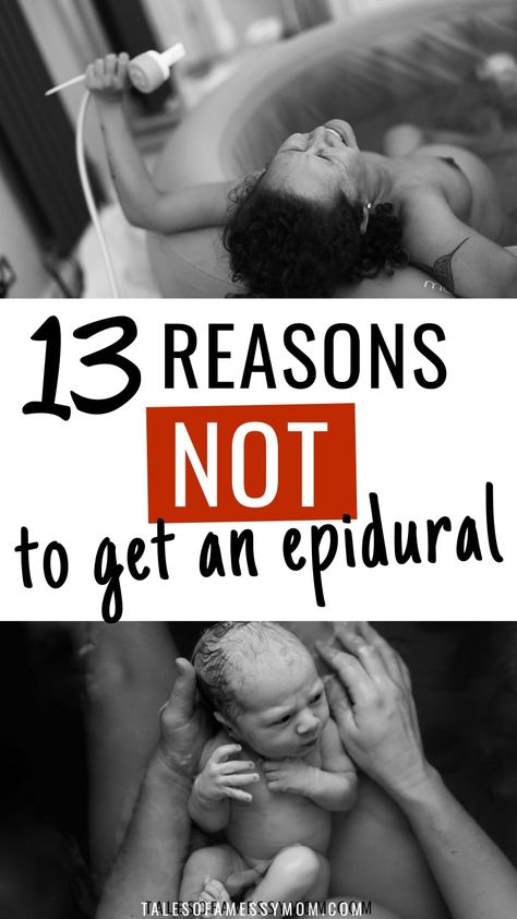 13 Reasons NOT to Get an Epidural - Tales of a Messy Mom Epidural Side Effects, Epidural Needle, Epidural Birth, Labor Tips, Natural Birthing Plan, Birth Prep, Birth Recovery, Unmedicated Birth, Pregnancy Labor