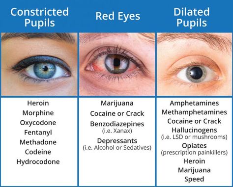 Pupil Dilation, Dilated Eyes, Emt Study, Dilated Pupils, Medical Student Study, Pharmacology Nursing, Nursing School Survival, Nursing School Studying, Medical Facts