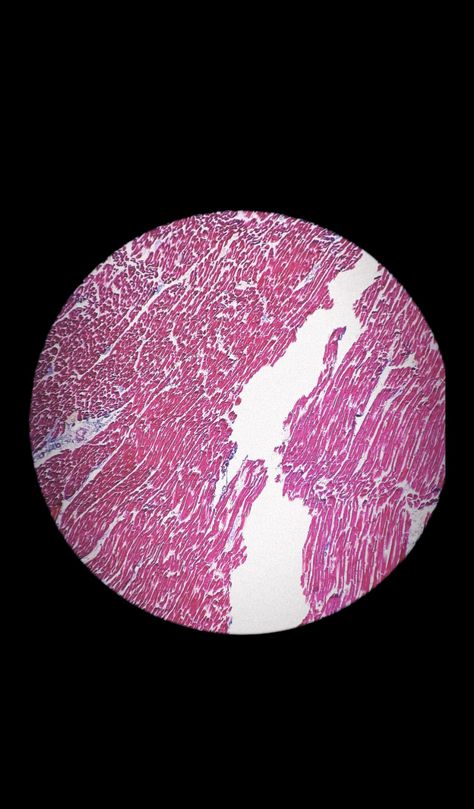 Muscle under microscope in histology Under Microscope, Human Tissue, Health Brand, Cells And Tissues, Good Night Love Images, Flower Fairy, Love Images, Knights, Random Stuff