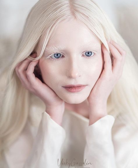 Platinum Blonde Hair And Blue Eyes, Albino Girl Aesthetic, Albino Eyes, Albino Woman, Swedish Makeup, Albino Model, Albino Girl, Oc Face Claims, Light Blue Eyes