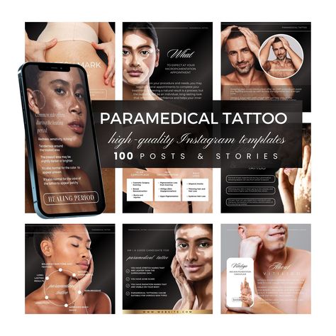 Paramedical Tattooing, Paramedical Tattoo, Scalp Micropigmentation, Stretch Mark, Instagram Content, Social Media Games, Template Instagram, Diy Template, Change Text