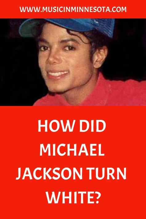 In Michael Jackson’s young days, he cruised his way into the heart of America as a member of the Jackson 5. As time went on, he became known as the King of Pop, giving the Michael Jackson Skin Disease, Michael Jackson Skin, Young Michael Jackson, Prince Michael Jackson, Holly Marie Combs, The Jackson 5, Psychology Disorders, Jackson 5, Lisa Marie Presley