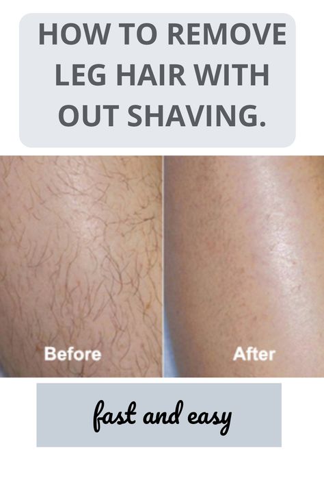 How To Remove Hair From Legs Naturally, How To Shave Legs Without Razor, How To Prevent Strawberry Legs After Shaving, How To Remove Hairs From Legs Naturally, How To Get Rid Of Hairy Legs, Smooth Legs Shave, How To Avoid Strawberry Legs When Shaving, Leg Hair Removal, Easy Hair Removal