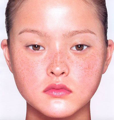 Devon Aoki - François Nars Getting Rid Of Freckles, Models Without Makeup, Brown Spots On Skin, Devon Aoki, Freckle Face, Brown Spots On Face, Nars Makeup, Skin Spots, Spots On Face