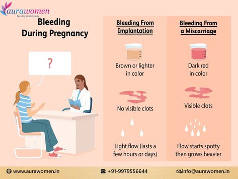 What is Implantation Bleeding?: Signs and Symptoms, Key Differences Implantation bleeding occurs when a fertilized egg attaches to the uterine lining, causing slight bleeding. This typically happens 10-14 days after conception and is lighter and shorter than a regular menstrual period. Signs include pink or brown discharge, mild cramping, and spotting. Differentiating factors include timing, flow consistency, and duration. Unlike a regular period, implantation bleeding usually lasts a day or... Period Signs, Menstrual Period, Fashion Terms, Signs And Symptoms, Fertility, Light In The Dark, Period, Egg, Key