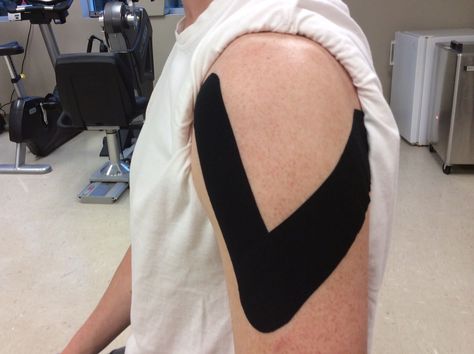 Learn how to apply kinesiology tape (KT tape) for your rotator cuff and shoulder to improve arm function of after injury. Shoulder Rehab Exercises, Rotator Cuff Surgery, Rotator Cuff Exercises, Shoulder Pain Exercises, K Tape, Shoulder Rehab, Rotator Cuff Tear, Shoulder Impingement, Rotator Cuff Injury