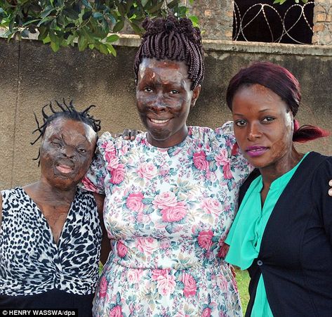 Inspirational: Acid victims Silvier Nambirige, Gloria Kankunda, director of the Center for Rehabilitation of Survivors of Acid and Burns Violence (CERESAV), and Linneti Kirungi, in Kampala, Uganda Three Months Pregnant, Burn Victims, Acid Attack, Kampala Uganda, Sally Nightmare Before Christmas, Brave Women, Intersectional Feminism, We Are The World, People Of The World