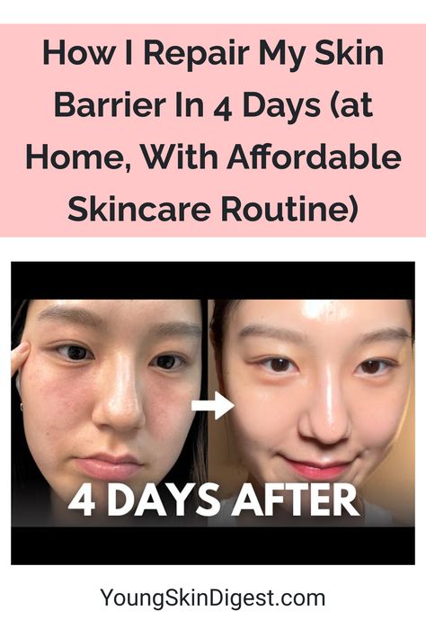 How I Repair My Skin Barrier In 4 Days (at Home, With Affordable Skincare Routine) How To Fix Damaged Skin Barrier, Skin Barrier, How To Heal Skin Barrier, How To Repair Skin Barrier, How To Restore Skin Barrier, Repairing Skin Barrier, Damaged Skin Barrier, Barrier Repair Skin Care Routine, Skin Barrier Repair Routine