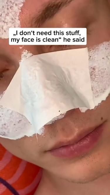 Remove your blackheads NOW !! Whiteheads Removal, Pore Extraction, Get Rid Of Pores, Sebaceous Filaments, Blind Pimple, Nose Pores, Blackheads On Nose, Clean Blackheads, Pore Strips