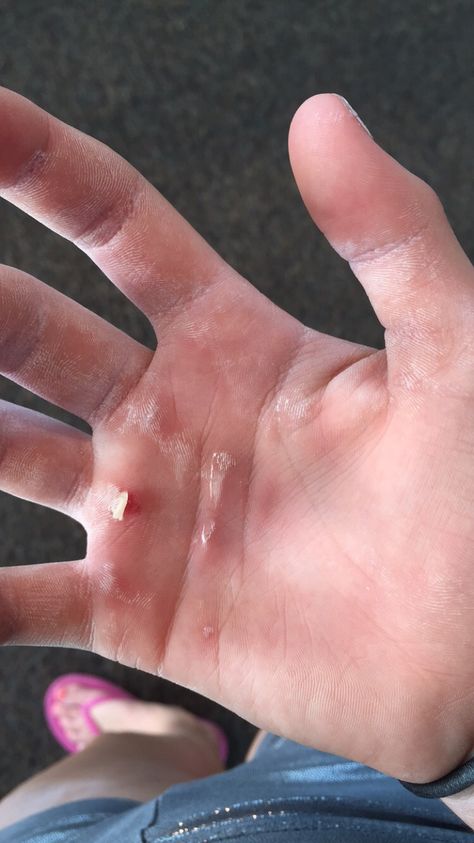 gymnast hands.. Gymnastics Rips Hands, Gymnastics Rips, Malak Core, Gymnast Aesthetic, Gymnastics Vibes, Gymnastics Gym, Gymnastics Photos, Hand Photography, Gymnastics Photography