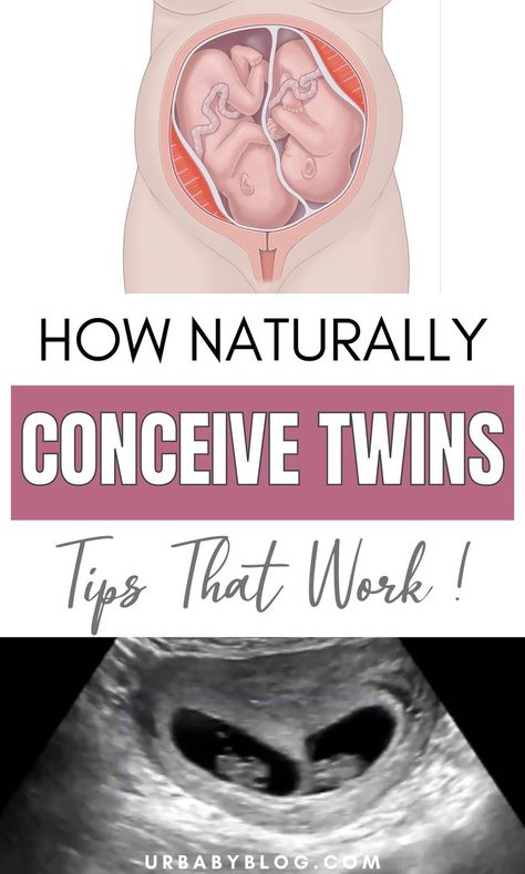 Did you know that you can actually make things work to get pregnant with twins? Yes, it sounds incredible, but there are certain ways that may be of help to you. #twins #conceivetwins #getpregnant #pregnancy #gettingpregnant Conceive Twins, Get Pregnant With Twins, How To Conceive Twins, Getting Pregnant With Twins, Help Getting Pregnant, Fertility Help, How To Conceive, Pregnant With Twins, Ways To Get Pregnant