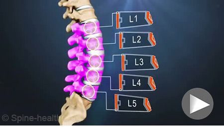 11 Ways to Indulge Your Spine. Lumbar Spine Anatomy Vertebrae L1 through L5 @ spine-health (Trusted Information for Back Pain Relief.. Anatomy Vertebrae, Lower Back Anatomy, Spine Anatomy, Disc Herniation, Spinal Health, Severe Back Pain, Middle Back Pain, Bulging Disc, Hip Problems