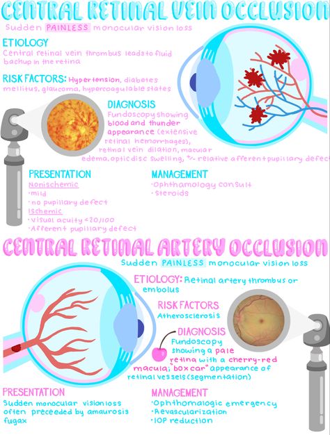 Opthalmic Technician, Optician Training, Optometry Education, Eye Medicine, Aesthetic Medical, Optometry School, Medical Notes, Eye Facts, Nursing Study Guide