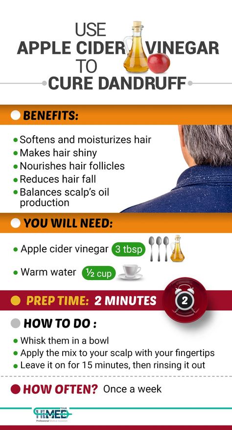 How to Get Rid of Dandruff?! Vinegar For Dandruff, Natural Dandruff Remedy, Hair Mask For Dandruff, Dandruff Solutions, Vinegar For Hair, Rid Of Dandruff, Apple Cider Vinegar For Hair, Homemade Hair Treatments, Dandruff Remedy