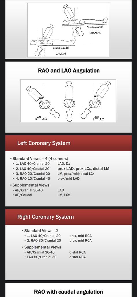 Cardiac Cath Lab Nurse, Cardiac Cath Lab, Cath Lab Nursing, Cardiac Cath, Cath Lab Nurse, Nurse Study, Nursing School Motivation, Nurse Study Notes, Cardiac Nursing