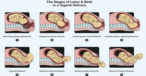 Follow simple tips for normal delivery of a healthy baby. MomJunction gives you the symptoms, process, and safety tips for a normal delivery. Read on! Diagram Infographic, Healthcare Illustration, Infographic Diagram, Midwifery Student, Stages Of Labor, Nursing Books, Normal Delivery, Birth Labor, Mom Junction