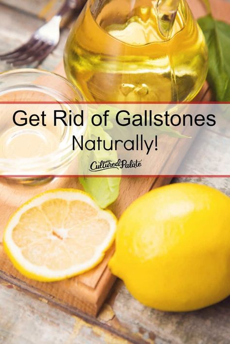 How to Get Rid of Gallstones gives a natural remedy, a gallbladder cleanse for a natural way to remove gallstones. #mycutluredpalate #gallbladdercleanse #naturalremedy #homeopathy How To Get Rid Of Gall Stones Naturally, Gallbladder Stones How To Get Rid, Gallstone Diet Gallbladder Cleanse, Gallstone Remedies, Gallstone Cleanse, Gallbladder Stones Diet, Liver And Gallbladder Cleanse, Gallstone Diet, Gallbladder Flush