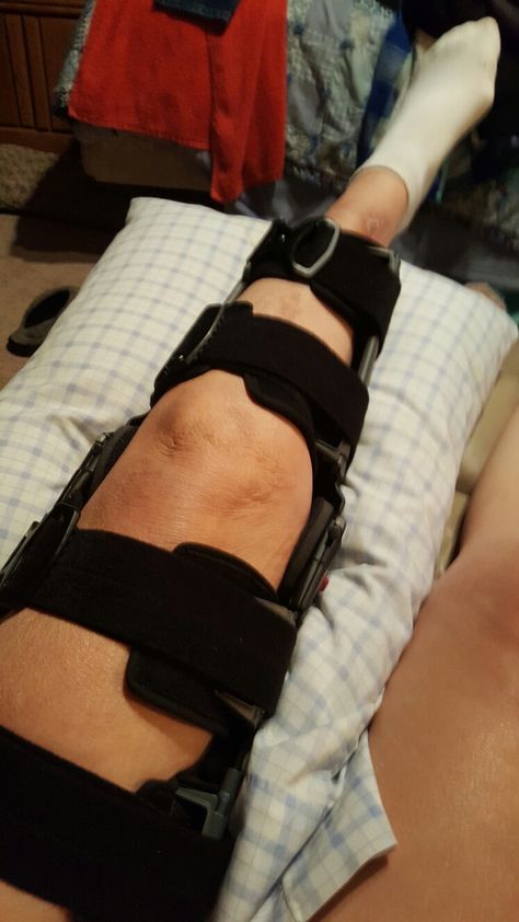 Knee Brace Aesthetic, Injury Aethstetic, Knee Injury Snapchat, Knee Brace Outfit, Injury Recovery Quotes, Injury Aesthetic, Knee Injury Recovery, Broken Knee, Knee Surgery Recovery