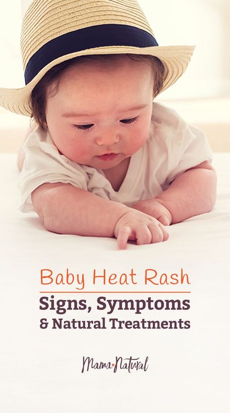 Baby Neck Rash, Heat Rash On Face, Face Rash Remedies, Baby Rash On Face, Baby Heat Rash, Heat Rash Remedy, Home Remedies For Rashes, Baby Skin Rash, Diaper Rash Remedy