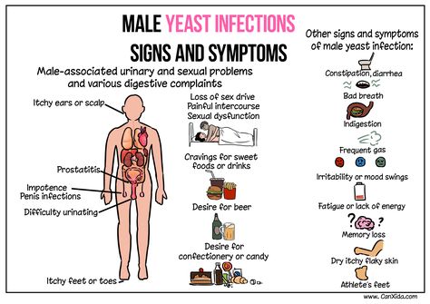 Yeast Infection Remedies Fast, Yeast Infection Pictures, Yeast Infection Men, Candida Supplements, Candida Yeast Infection, Yeast Infection Symptoms, Candida Cleanse, Candida Yeast, Yeast Infections