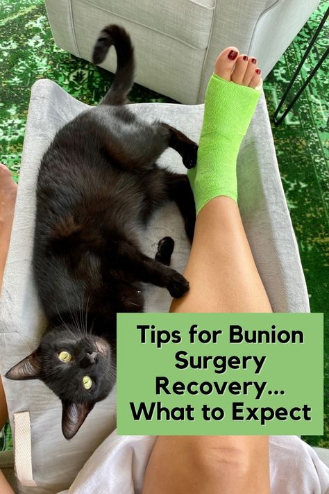 Achilles Surgery Recovery Tips, Bunionette Taping, Lapiplasty Surgery, Bunionectomy Recovery, Bunionette Surgery, Intention Board, Surgery Prep, Surgery Care Package, Preparing For Surgery