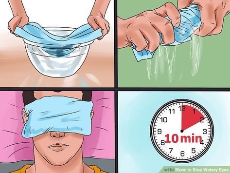 Image titled Stop Watery Eyes Step 4 Watery Eyes Remedy, Eyes Blinking, Eye Function, How To Help Nausea, Eye Twitching, Eyes Watering, Irritated Eye, Eye Infections, Watery Eyes