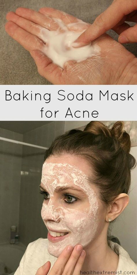 Baking Soda Mask for Acne - Prevents breakouts and fights acne Mask For Acne Prone Skin, Baking Soda Mask, Face Mask For Acne, Baking Soda Face Mask, Mask For Acne, Baking Soda Face, Tumeric Face Mask, Natural Kitchen, Face Mask Recipe