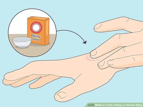 3 Ways to Treat a Wasp or Hornet Sting - wikiHow Red Wasp Sting, Wasp Stings Relief, Wasp Sting Remedy, Hornet Sting, Wasp Sting, Red Wasps, Getting Rid Of Bees, Sting Relief, These Things Happen