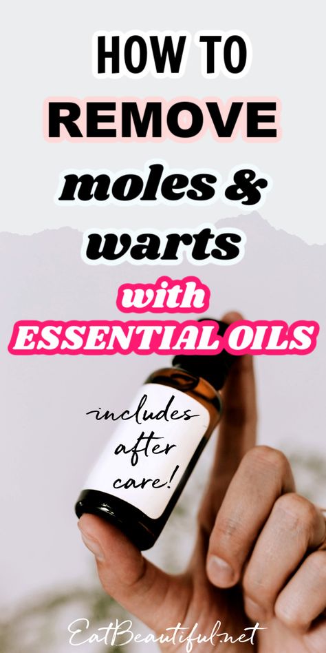 Removing Moles Naturally, Warts How To Get Rid Of, Remove Moles Naturally, Wart Remedies, Natural Wart Remover, How To Remove Moles, Face Warts, Moles On Face, Remove Moles