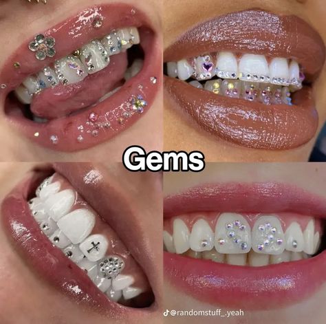 Silver Teeth, Tooth Jems Idea, Tooth Gems Design, Tooth Gems Simple, Teeth Jewelry Tooth Gems Women, Teeth Jems Aesthetic, Strass Teeth, Tooth Gems Aesthetic, Tooth Gem Placement