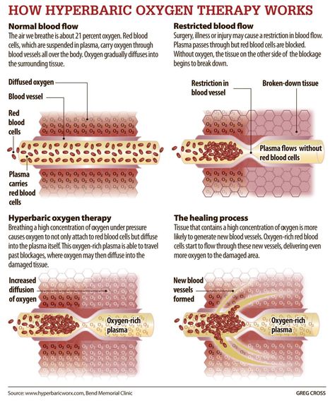 Hyperbaric Oxygen Therapy, Face Pores, Brain Facts, Oxygen Therapy, Mental Health Facts, Nursing School Notes, Iv Therapy, Stem Cell Therapy, Regenerative Medicine