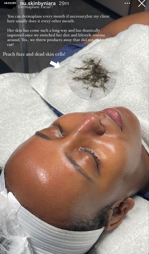 Facial Esthetics, Esthetician Inspiration, Medical Esthetician, Esthetician School, Esthetician Marketing, Skin Facts, Skin Care Business, Skin Aesthetics, Beauty Therapy