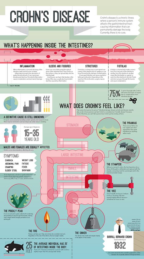 Crohn's Disease - An Infographic. by B. R. Keller, via Behance Chrones Disease, Crohns Diet, Chrons Disease, Crohns Awareness, Chronic Disease, Autoimmune Disease, Migraine, Health Tips, Disease